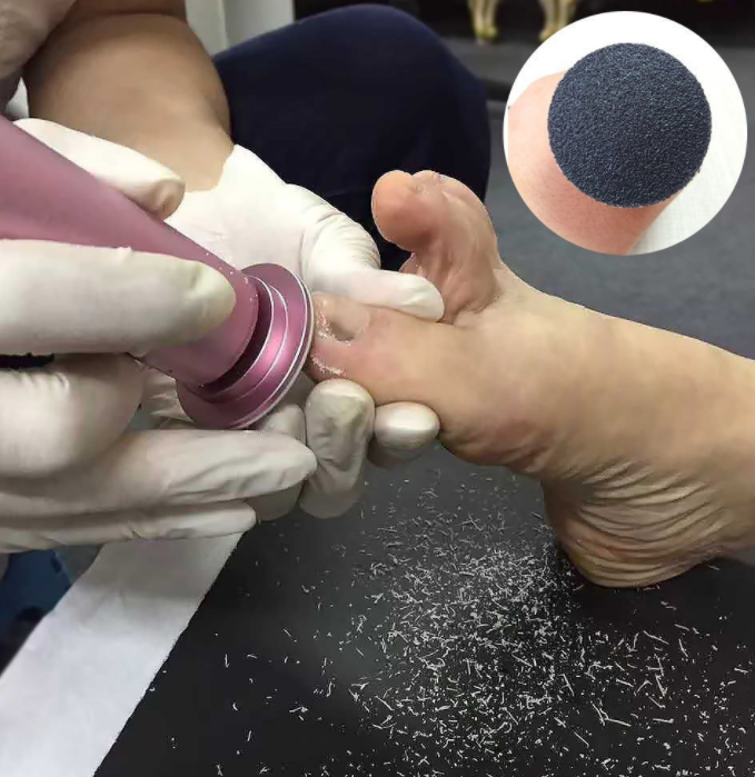 foot callus remover baby magazin 